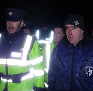 Click on image to see full-sized version Pat O'Donnell after Garda Assault