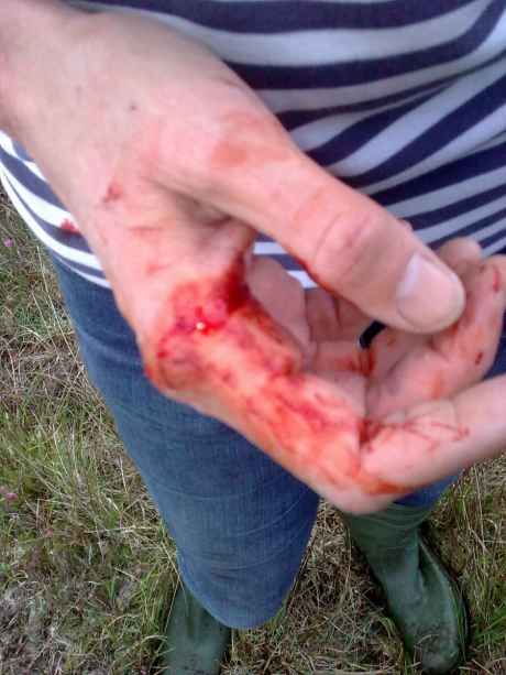 injury from IRMS