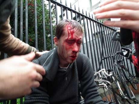 Click on image to see full-sized version Victim of Garda Assault at student anti-cuts demo