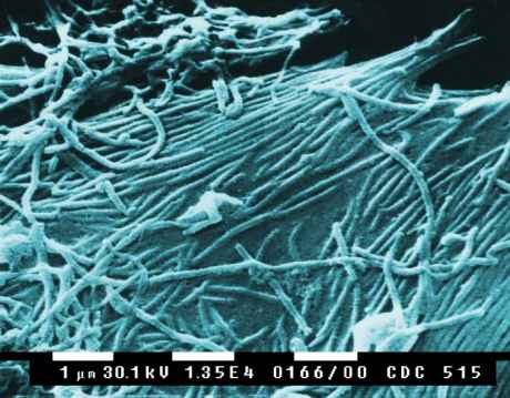 Click on image to see full-sized version ebola_virus.jpg